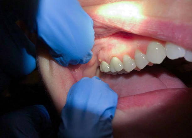 Best Orthodontic Emergency Dentist in Olympia, SC
