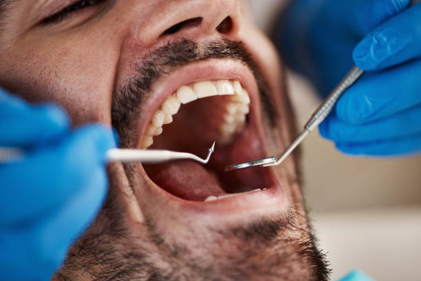 Best Emergency Dentist for Special Needs Patients in Olympia, SC
