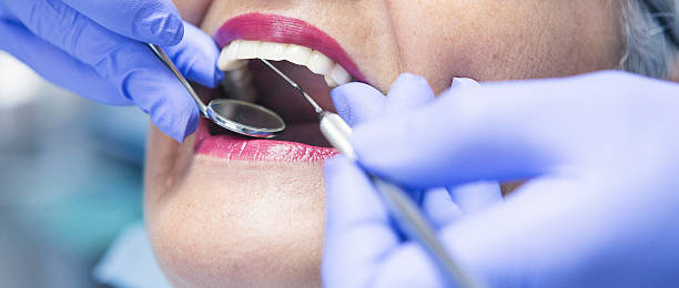 Best Emergency Cosmetic Dentistry in Olympia, SC